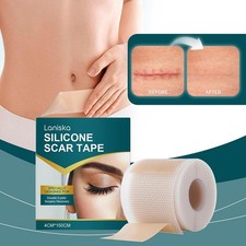 1* Silicone Scar