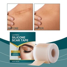Silicone Scar Sheets,Silicone