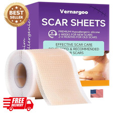 Silicone Scar Sheets